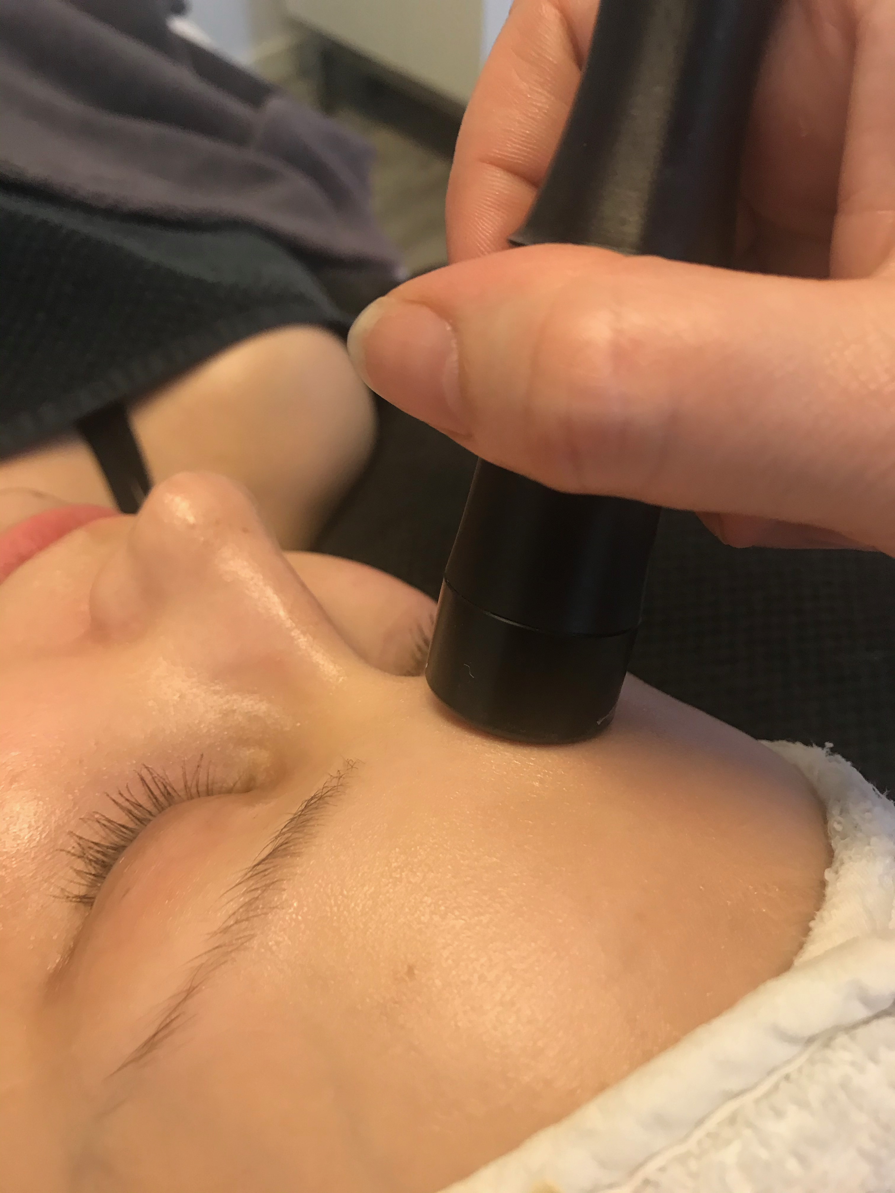 Kuva 30 minuutin RF kasvohoidosta Kauneus- & Komeushoitola Sanna's Stylessä