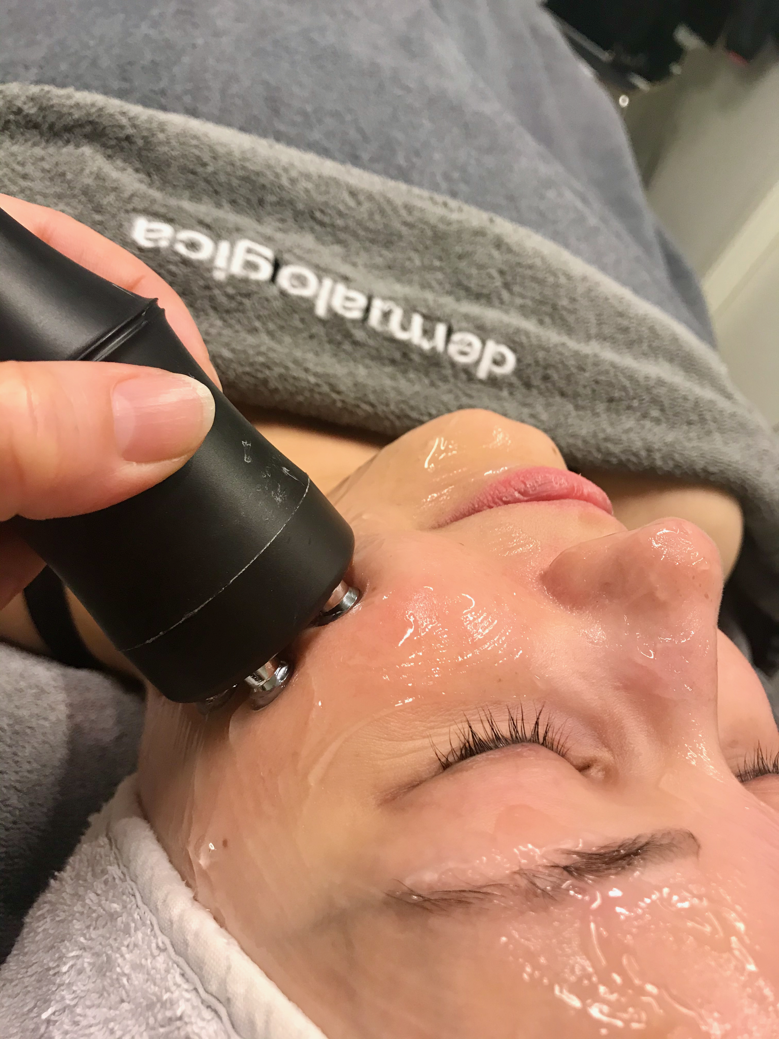 Kuva 60 minuutin RF kasvohoidosta Kauneus- & Komeushoitola Sanna's Stylessä