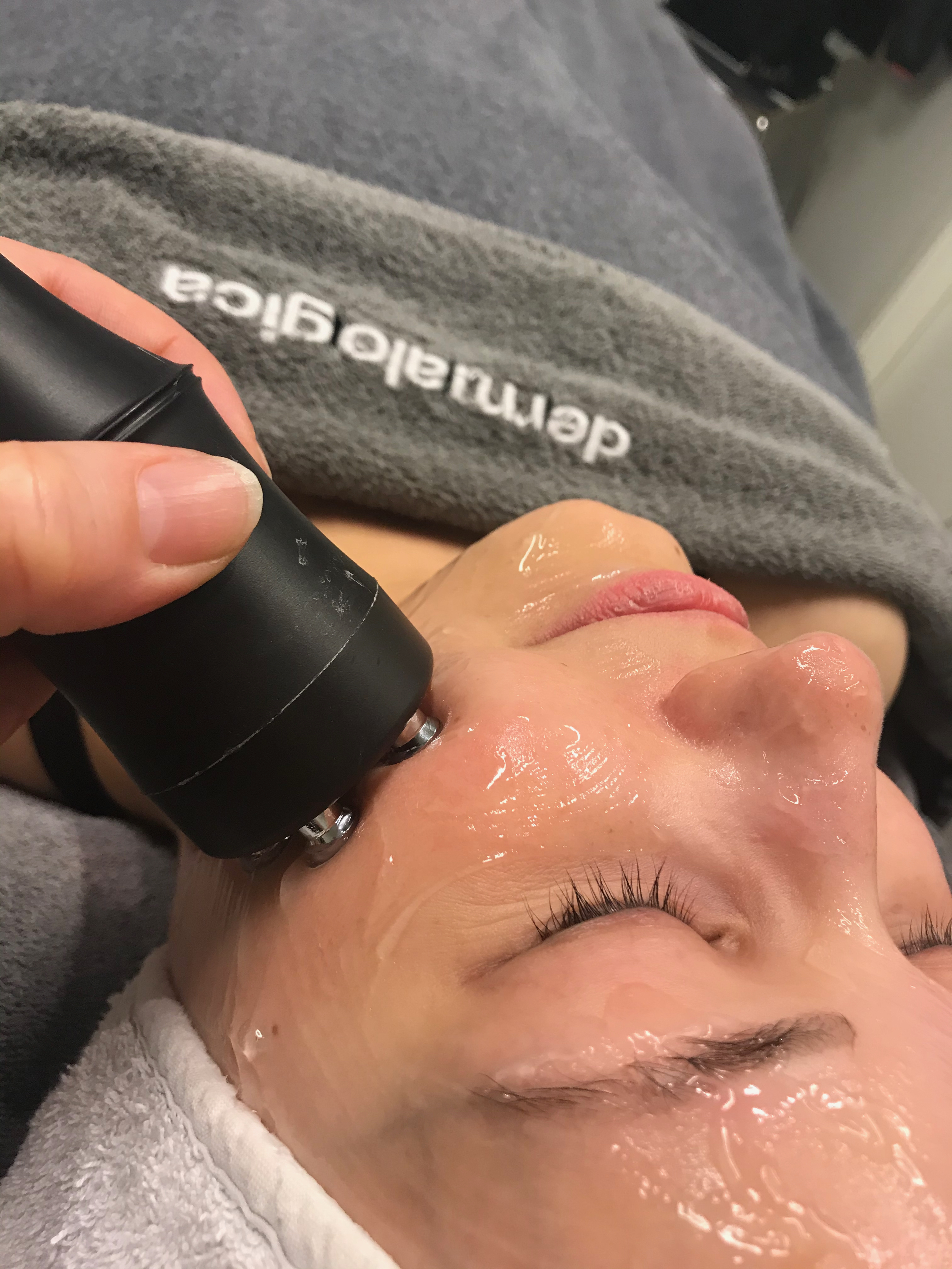 Kuva 90 minuutin RF kasvohoidosta Kauneus- & Komeushoitola Sanna's Stylessä