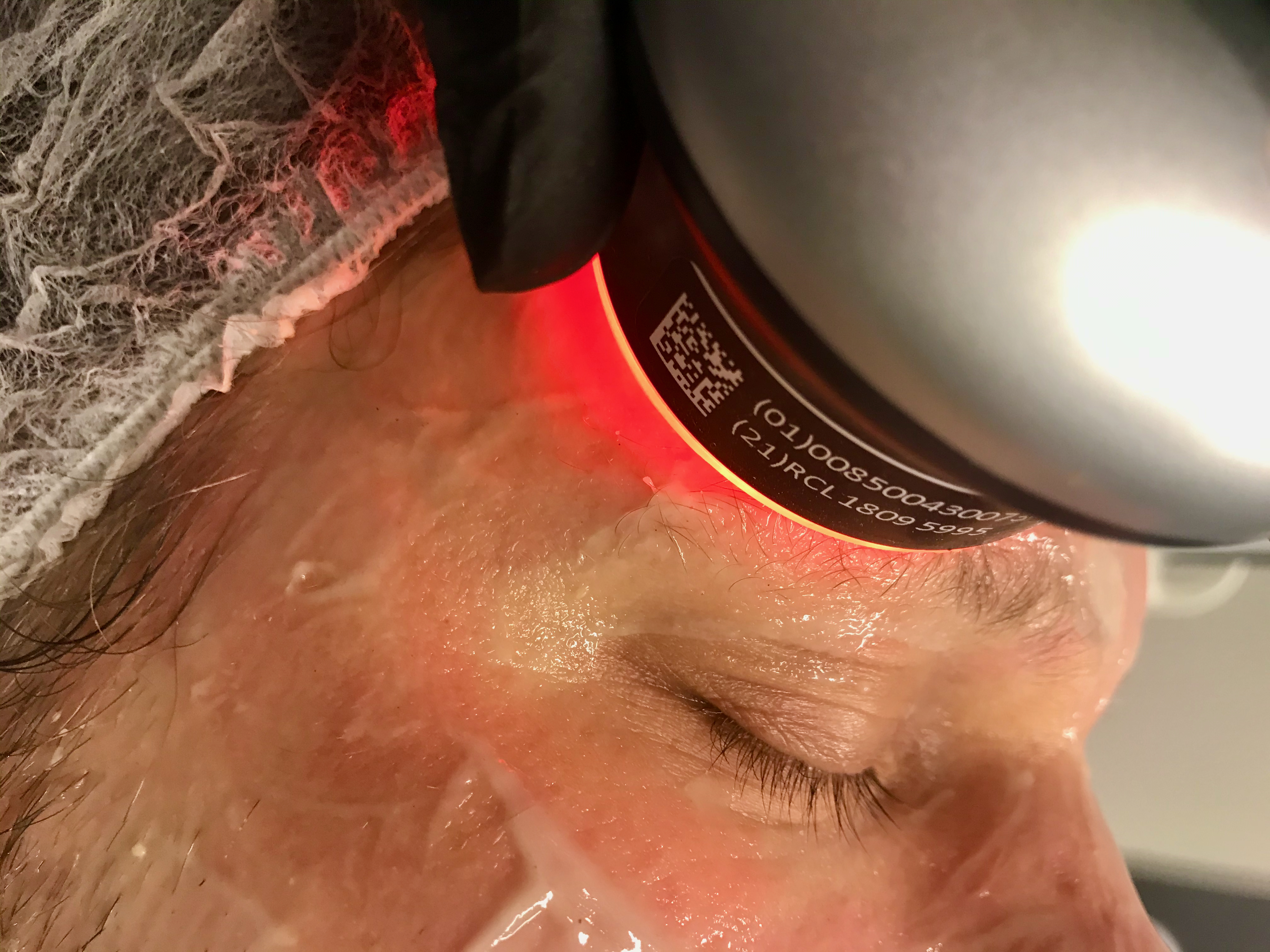 Kuva hydrafacial™ Age Refinement kasvohoidosta Kauneus- & Komeushoitola Sanna's Stylessä