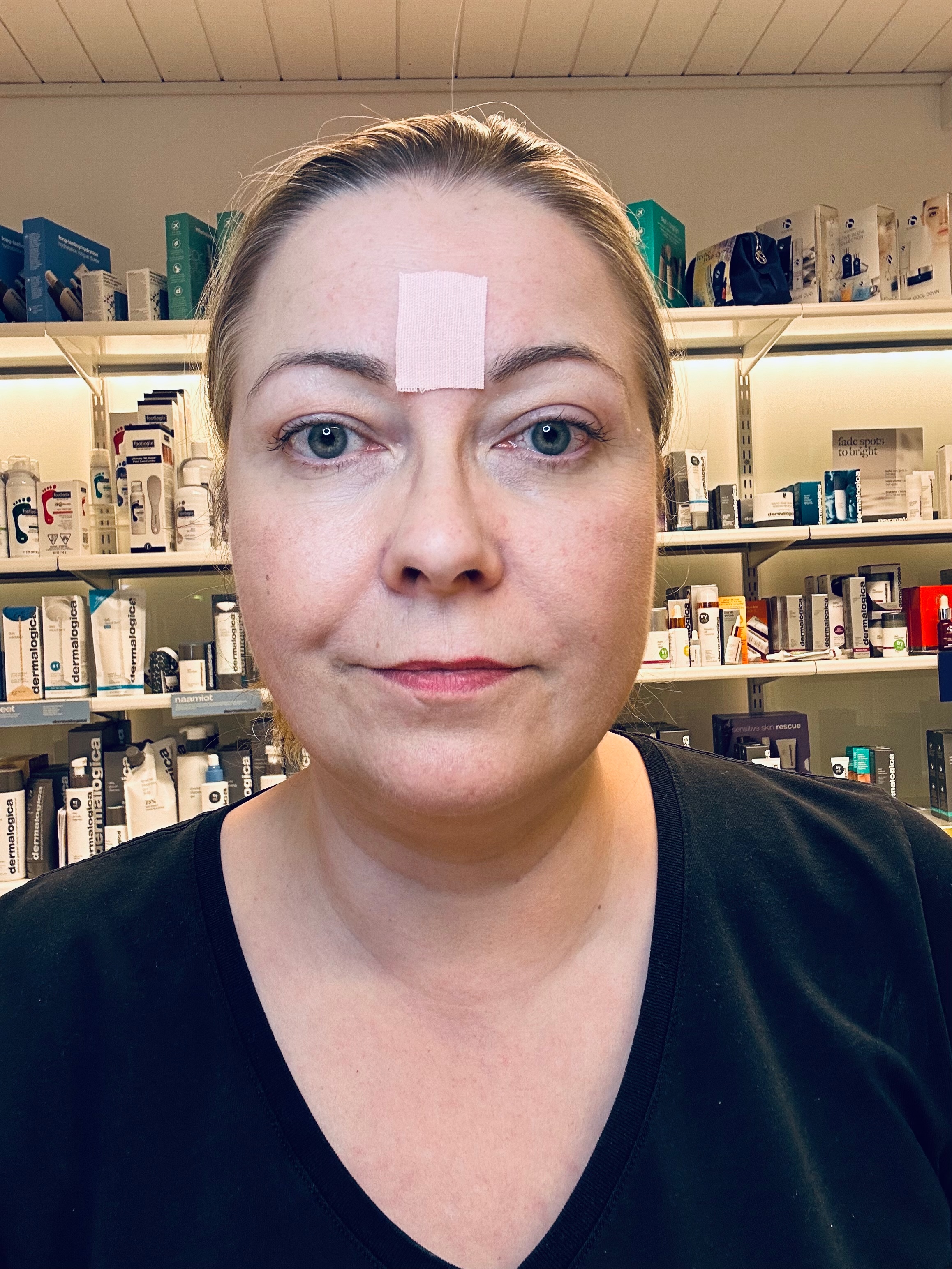 Kineesioteippaus sibelius rypylle