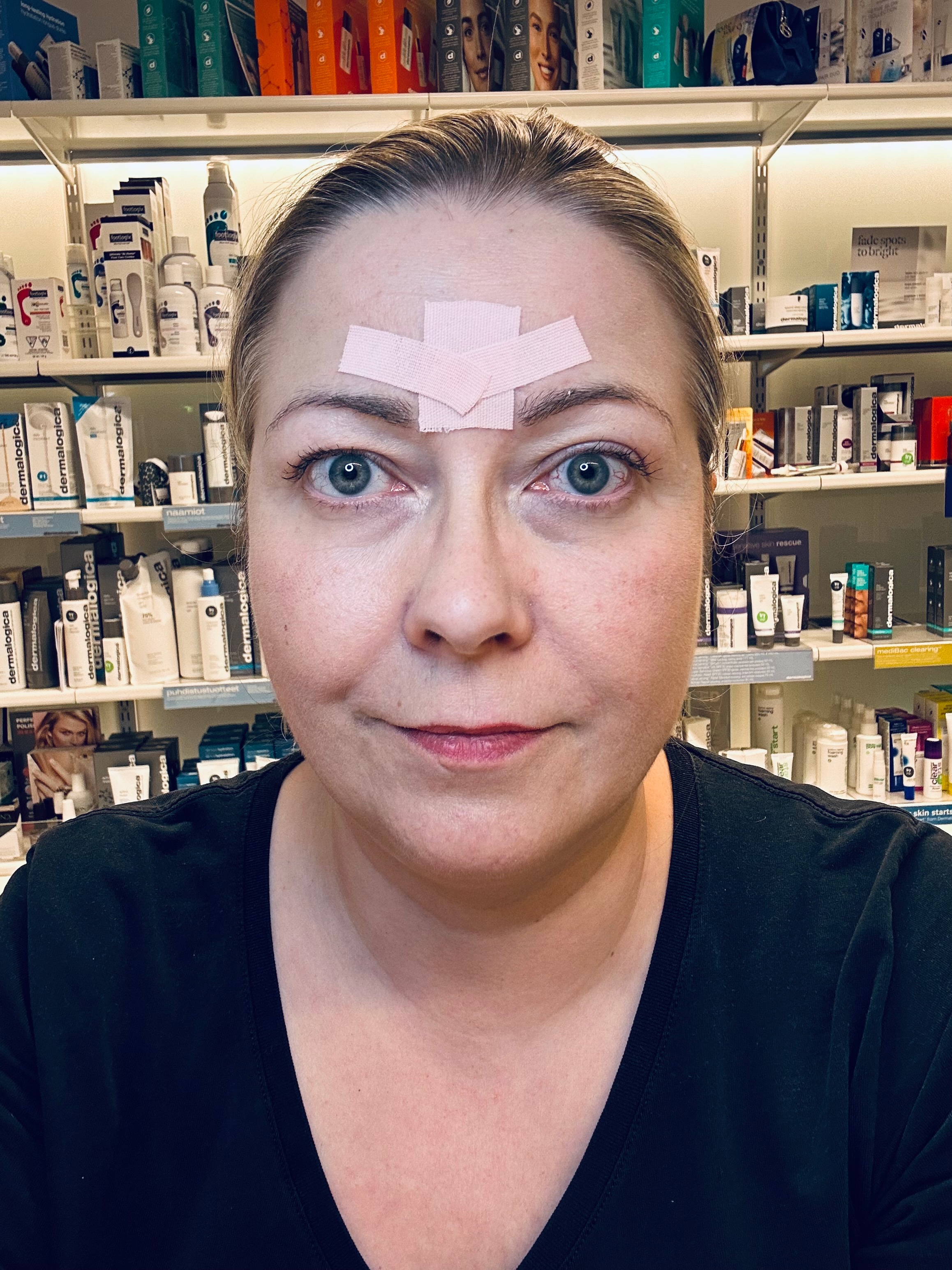 Kinesioteippaus vahvoille sibelius rypyille