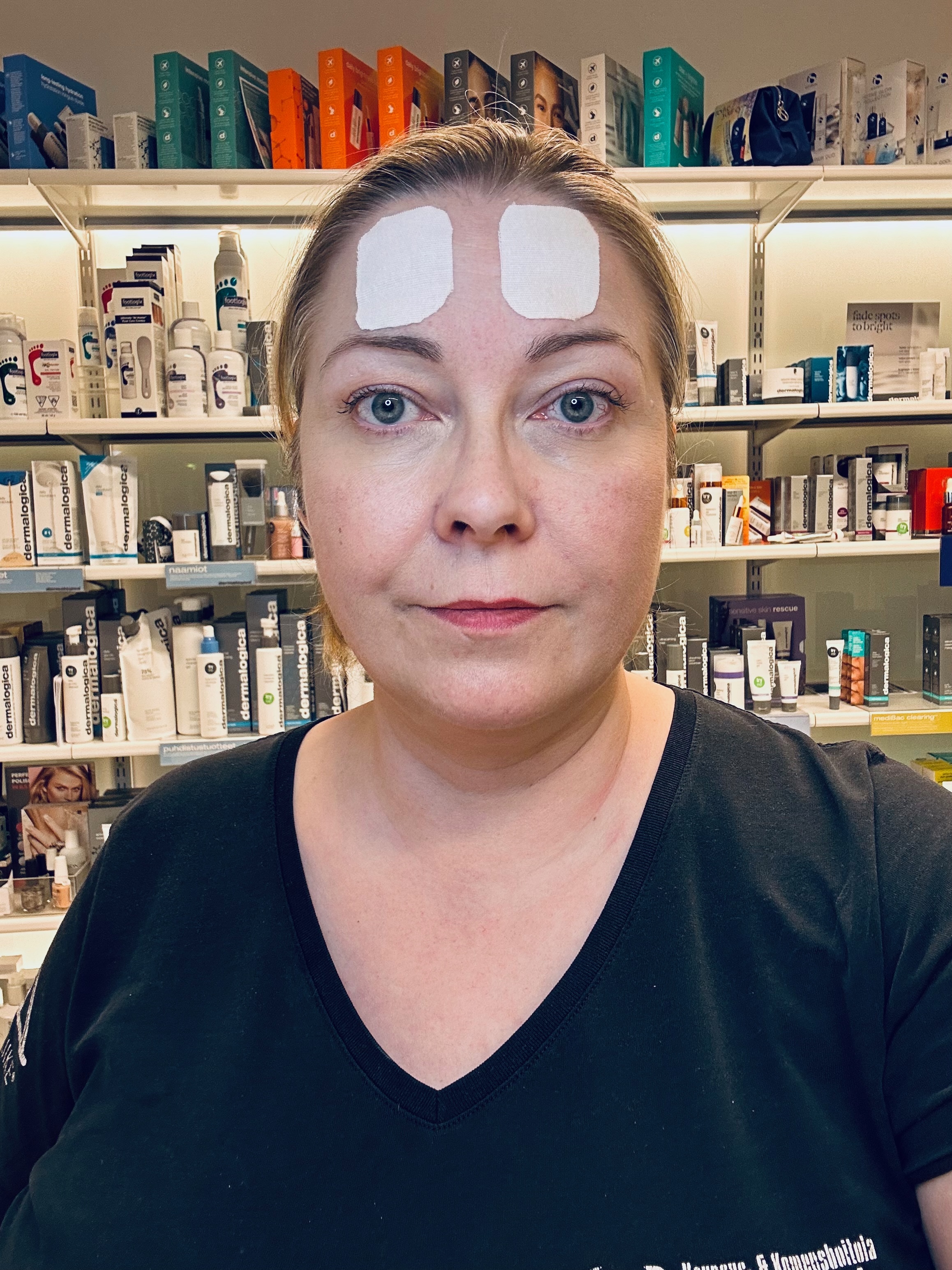 Kinesioteippaus poikittaisille otsa rypyille